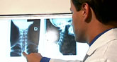 Chiropractor in Manassas VA X-ray 